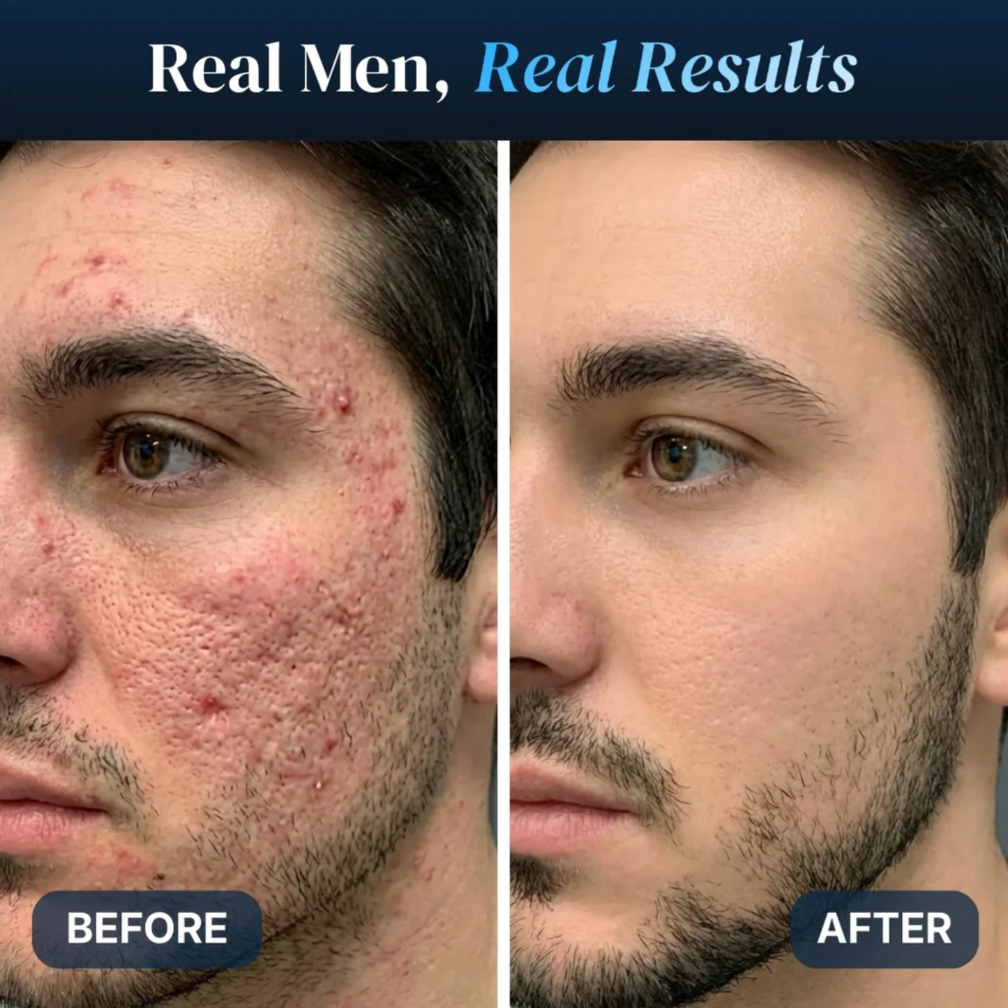 Phase GHK-Cu 1% Serum