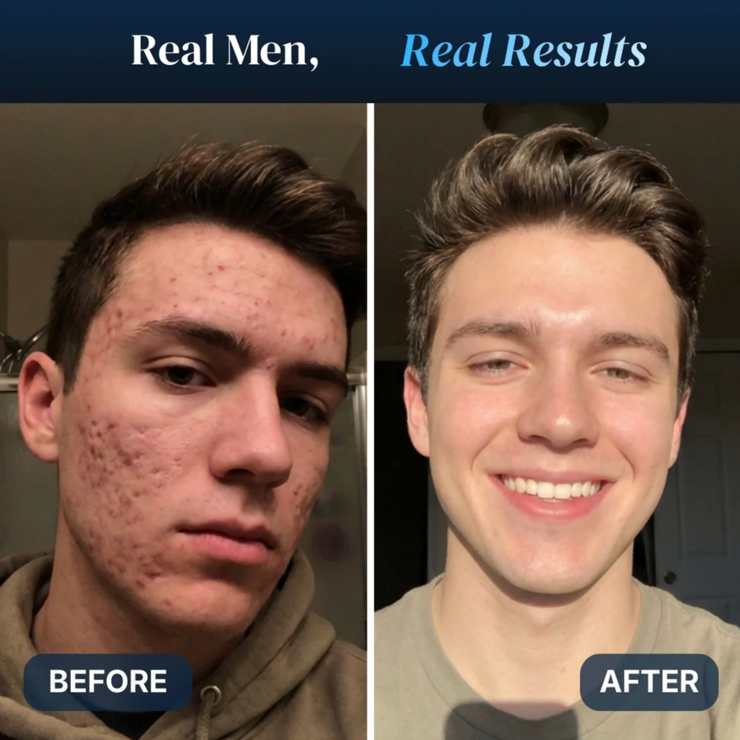 Phase GHK-Cu 1% Serum