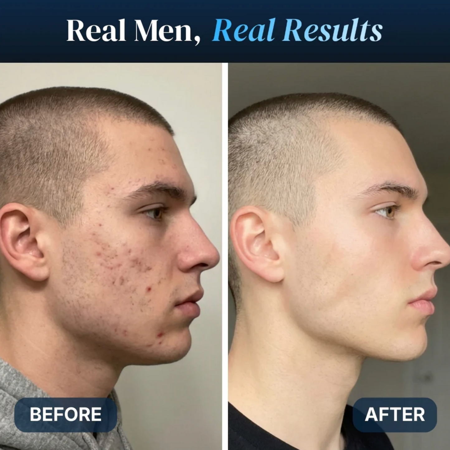 Phase GHK-Cu 1% Serum