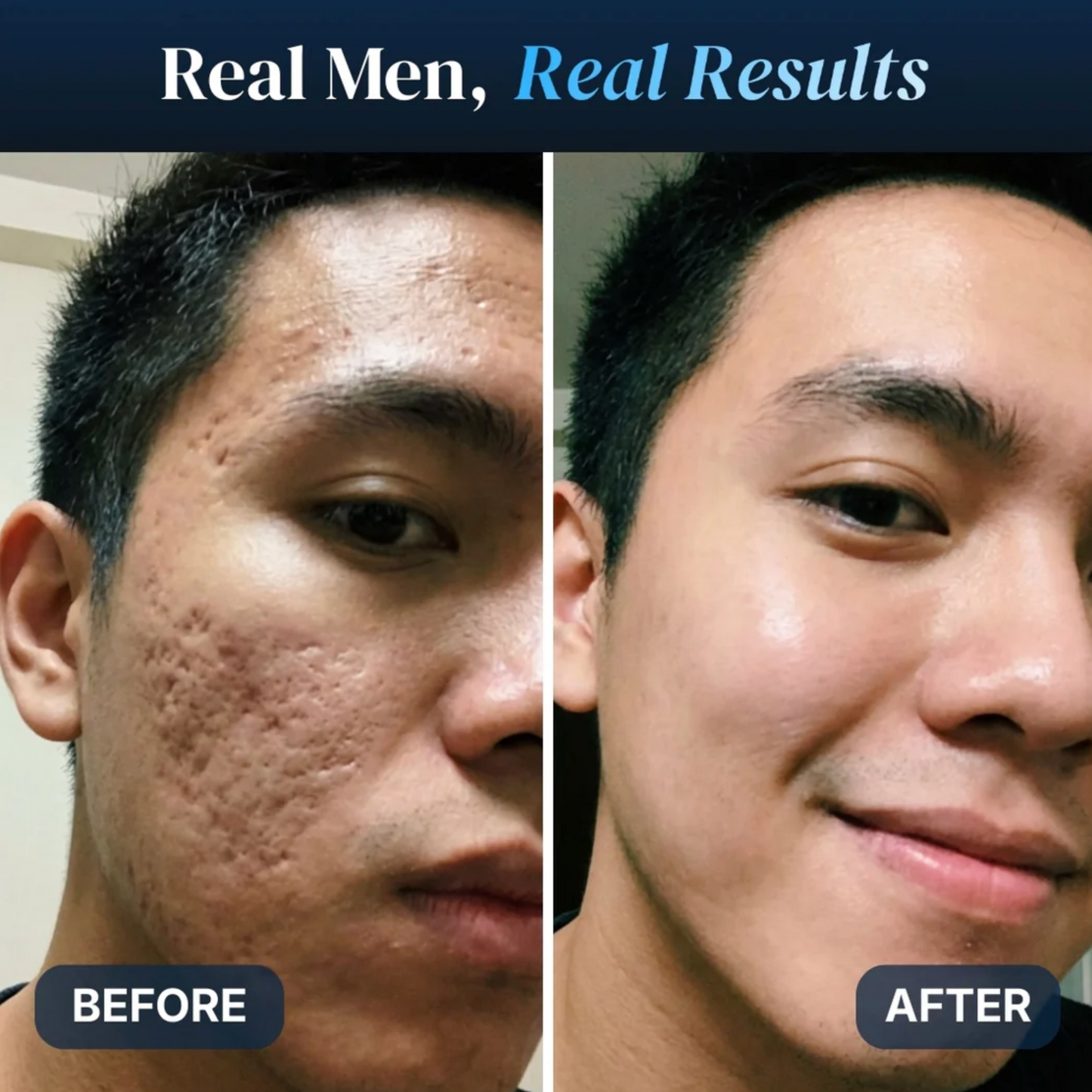 Phase GHK-Cu 1% Serum